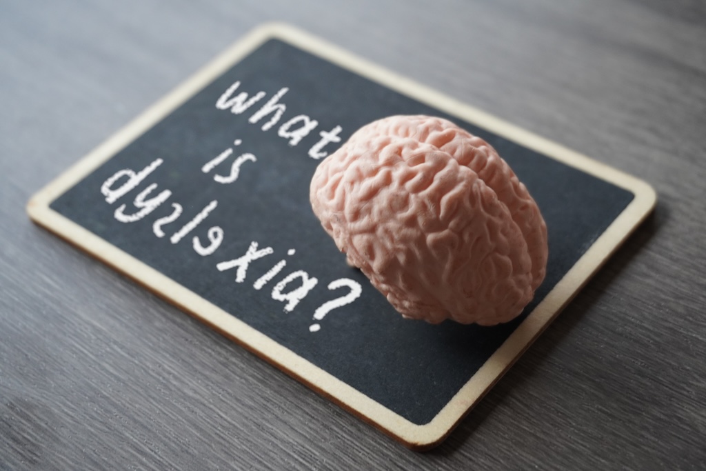 Closeup image of human brain model and chalkboard with text WHAT IS DYSLEXIA?